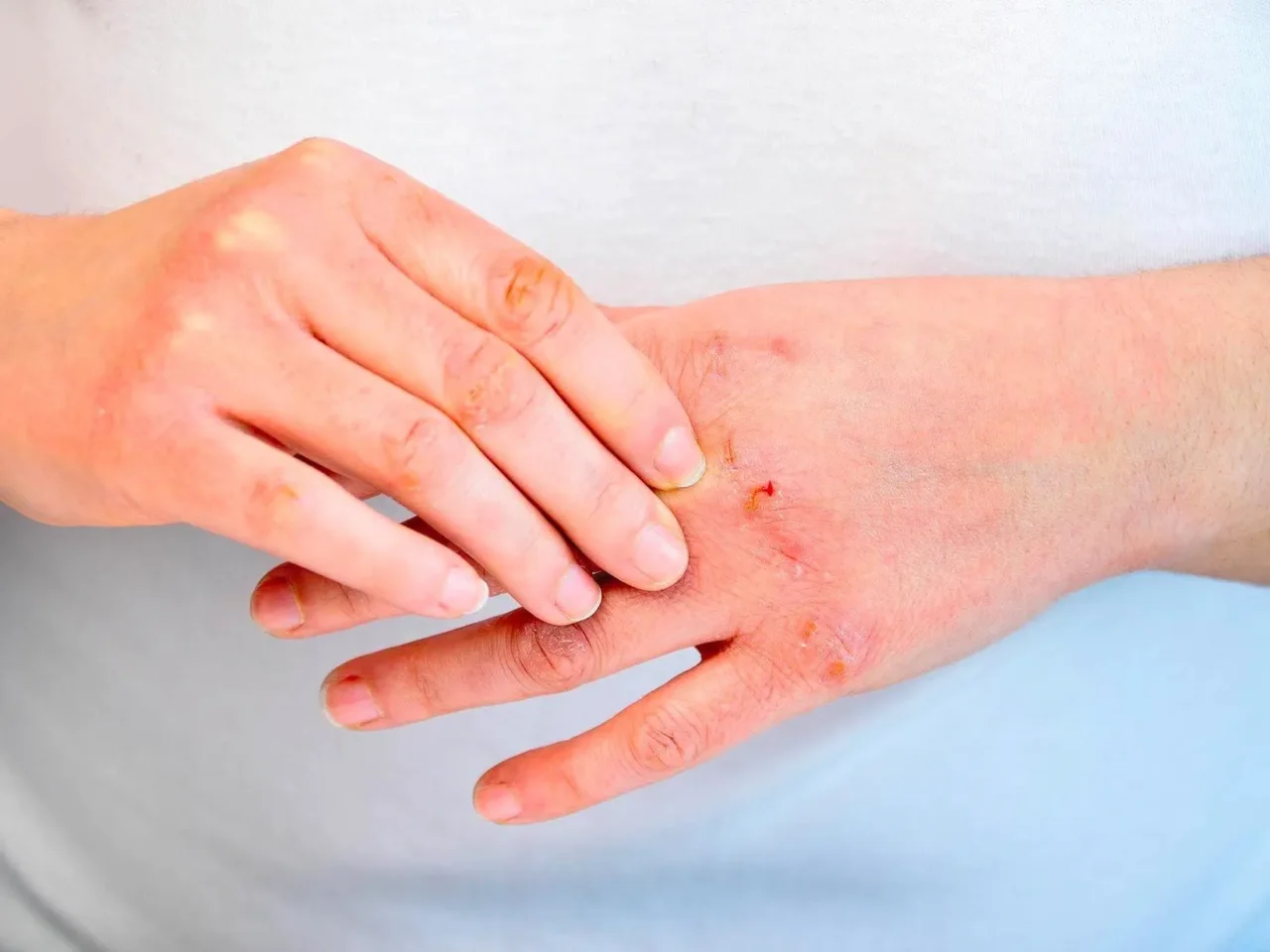 La tua pelle ha problemi? Ecco a chi devi rivolgerti per risolverli davvero